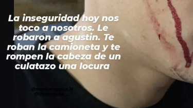 Sandez exhibió lo vivido en redes sociales, alertando que tambien robaron su celular.&nbsp;