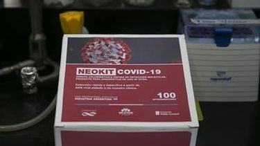 ¿Cómo funcionan los test rápidos diseñados por el Conicet?