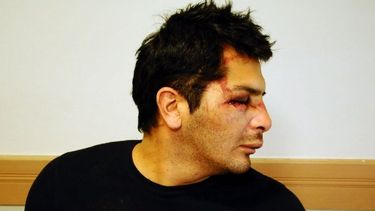 Imputan a un cuarto policía por una golpiza