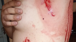 Ataque. El malviviente enfrentó a la víctima con un elemento punzante. Ataque. El malviviente enfrentó a la víctima con un elemento punzante.