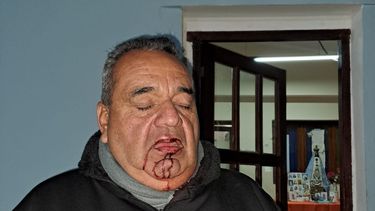 Claudio Fernández, director de la Policía Vial Municipal de Recreo