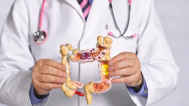 cancer de colon: se diagnostican en promedio mas de 40 casos por dia en la argentina