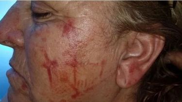 Brutal golpiza: un ladrón le pateó la cabeza a una señora de 60 años