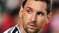 que le paso a lionel messi en el ojo derecho durante el cruce ante suiza