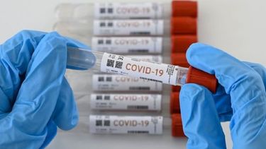 Coronavirus en Catamarca: hoy se detectaron 27 casos positivos