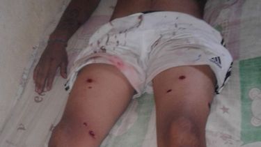 Denuncian agresión policial en Andalgalá