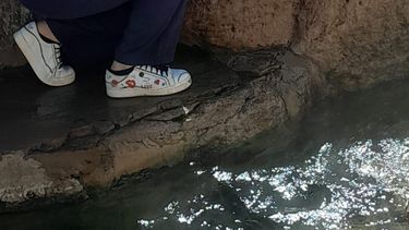 ¿Es seguro usar piletas  y termas? La explicación de una especialista