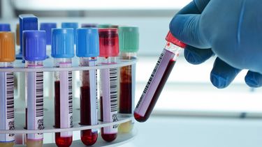 Bioquímicos adelantan que trasladarán gastos a los afiliados