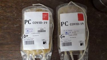 34 fallecidos y 2.606 nuevos casos de coronavirus en el país