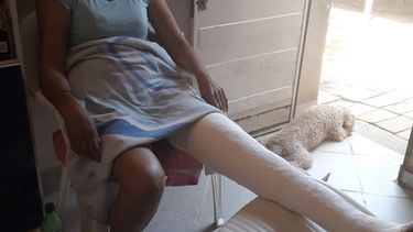 En un arrebato una mujer sufrió doble fractura en una pierna