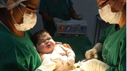 Nació un bebé gigante de 7,3 kg en Brasil