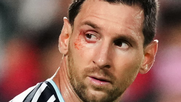 Qué le pasó a Lionel Messi en el ojo derecho durante el cruce ante Suiza