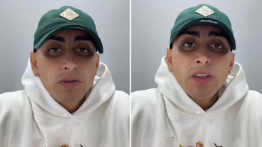 el villano conto que le diagnosticaron vih y llamo a una concientizacion