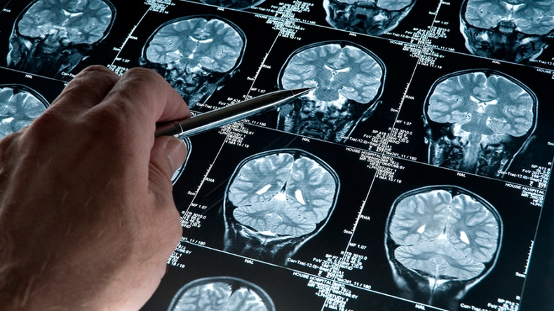 La herramienta argentina para el diagn&oacute;stico precoz del mal de Alzheimer y otros trastornos neurodegenerativos.