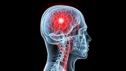 ACV: una urgencia médica en la que cada minuto cuenta