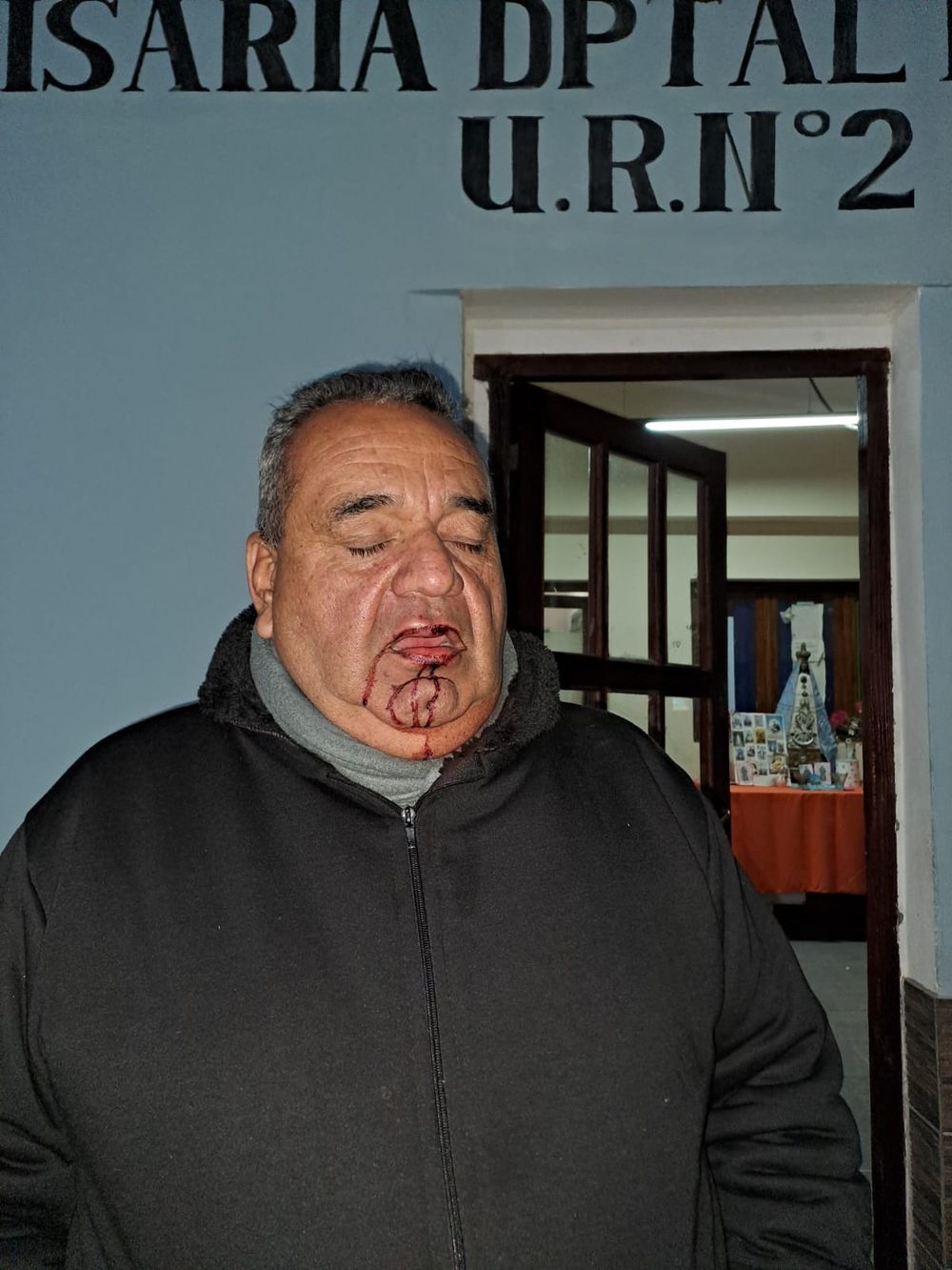 Herido. Claudio Fernández.