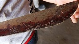 Barrio 140 Viviendas: le abrieron la cabeza con un machete a una mujer