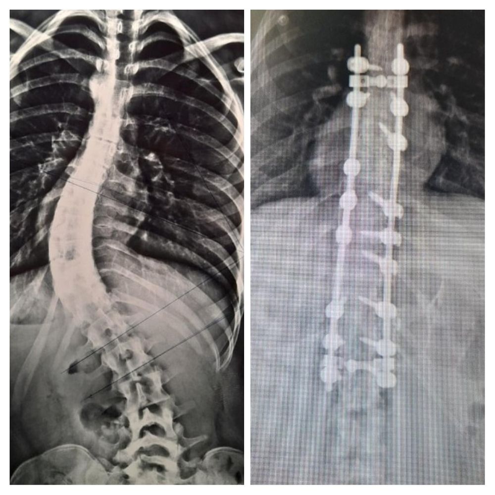 CIRUGIA COMUNA HISJB - MINISTERIO DE SALUD.jpeg