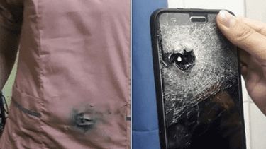 Ladrones le dispararon en el abdomen pero su celular le salvó la vida