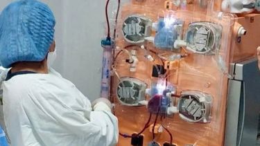El Hospital de Niños incorporó una terapia de reemplazo renal El Hospital de Niños incorporó una terapia de reemplazo renal