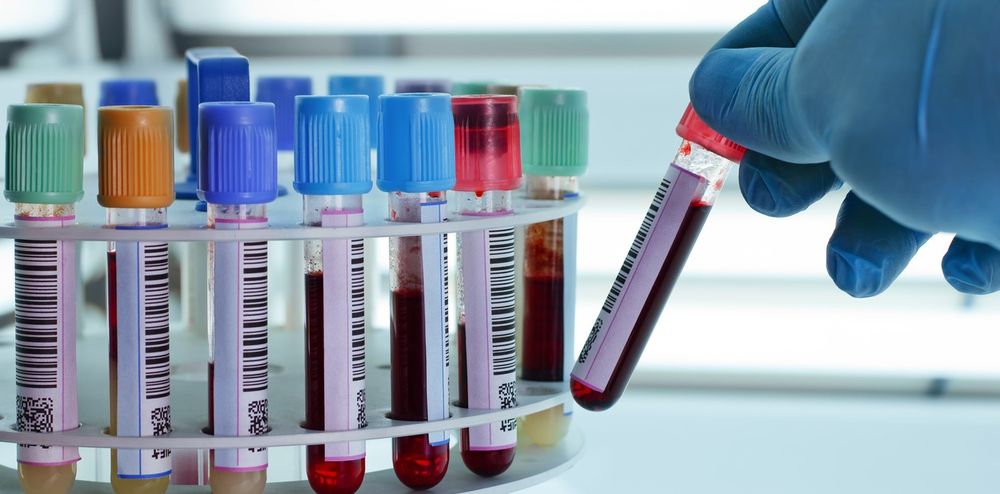 Extracciones. Los bioquímicos, afectados por el precio del dólar.
