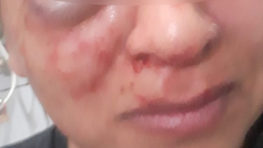 Una mujer pidió medidas urgentes tras sufrir salvaje golpiza
