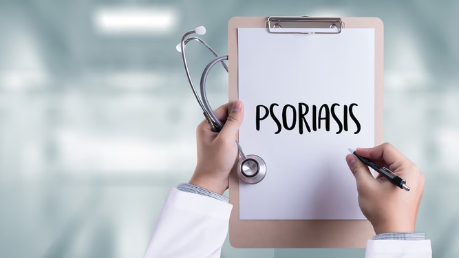 El 42% de los pacientes con psoriasis postergó o suspendió la consulta médica por motivos económicos