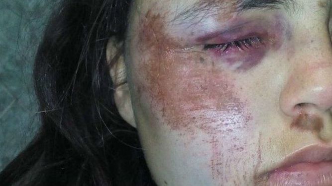 Violó la perimetral y con otros tres hombres molió a golpes a su ex