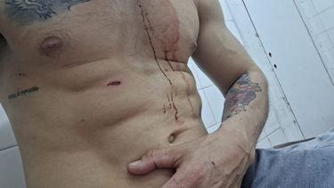 Herido. El comerciante recibió un puntazo en el abdomen.