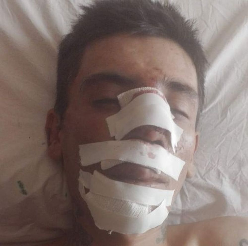 Salvaje. Una banda lo sorprendió y atacó en medio de una calle.