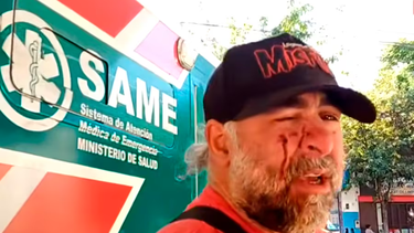 hablo el camarografo agredido por la policia federal: me pegaban patadas por abajo