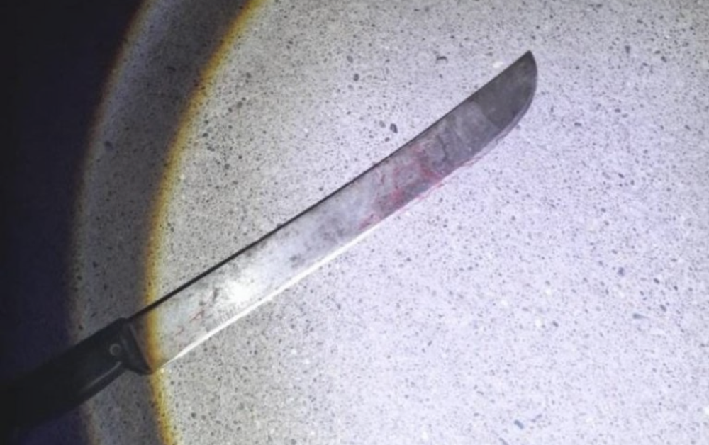 Un hombre le amputó varios dedos con un machete a un ladrón que entró a su casa