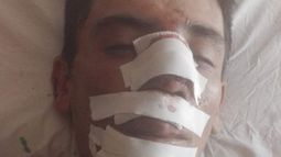 Salvaje. Una banda lo sorprendió y atacó en medio de una calle.