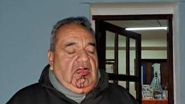 Herido. Claudio Fernández.