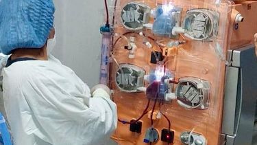 el hospital de ninos incorpora un tratamiento innovador para pacientes criticos