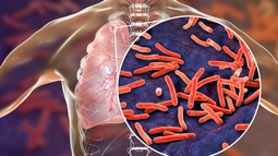 Científicos argentinos desarrollaron un test rápido para el diagnóstico de la tuberculosis