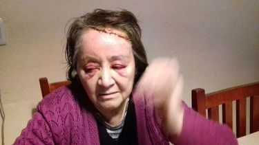 Violento asalto contra dos hermanas en la zona Norte