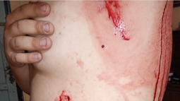 Un joven enfrentó a un ladrón en su casa y fue apuñalado Un joven enfrentó a un ladrón en su casa y fue apuñalado