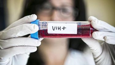Tercer caso de cura de VIH por un tratamiento de trasplante de cédulas madre.&nbsp;